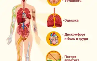 Первые признаки хронической сердечной недостаточности: что нужно знать