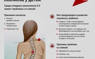 Детский сколиоз: советы по профилактике и лечению для родителей
