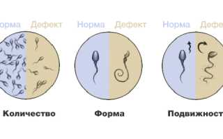 Мужское бесплодие: причины, диагностика, лечение и профилактика