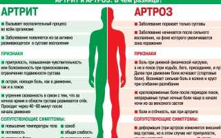 Почему артрит не перепутаешь с артрозом, причины появления этих заболеваний и их отличия