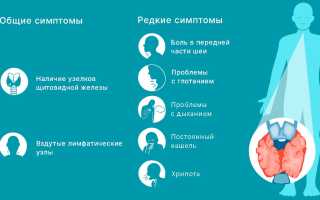 Первые признаки рака щитовидной железы: что нужно знать
