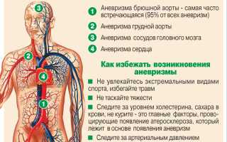 Ранние признаки аневризмы сосудов головного мозга: что нужно знать