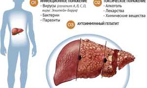 Если у мужа болит печень, что делать?
