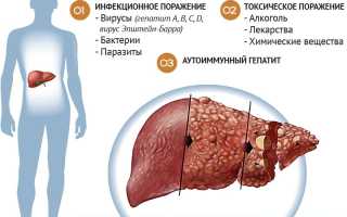 Если у мужа болит печень, что делать?