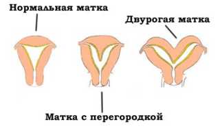 Поперечное положение плода – как рожать и можно ли изменить