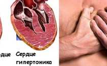 Лекарства от повышенного давления и совместимость с алкоголем