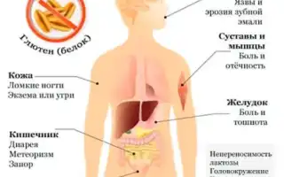 Симптомы непереносимости глютена и их проявления