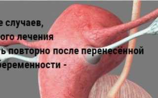 Каков шанс зачать после вмб и что надо предпринять