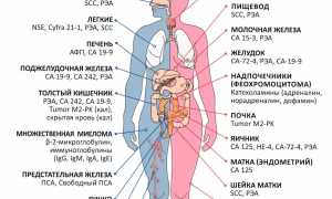 Когда надо сдавать анализы на онкомаркеры: причины, симптомы, как и где сдают, важные рекомендации