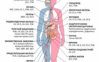 Когда надо сдавать анализы на онкомаркеры: причины, симптомы, как и где сдают, важные рекомендации