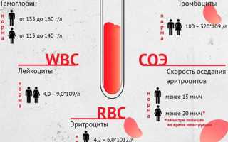 Общий анализ крови или о чем расскажет кровь для здоровья