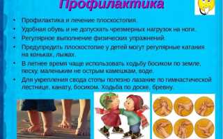 Детское плоскостопие: легче предупредить, чем лечить, советы и рекомендации