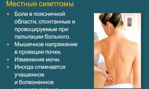Что делать, если болят почки: полезные советы и рекомендации