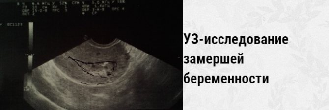 узи