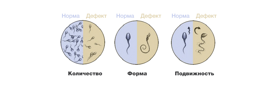 Мужское бесплодие