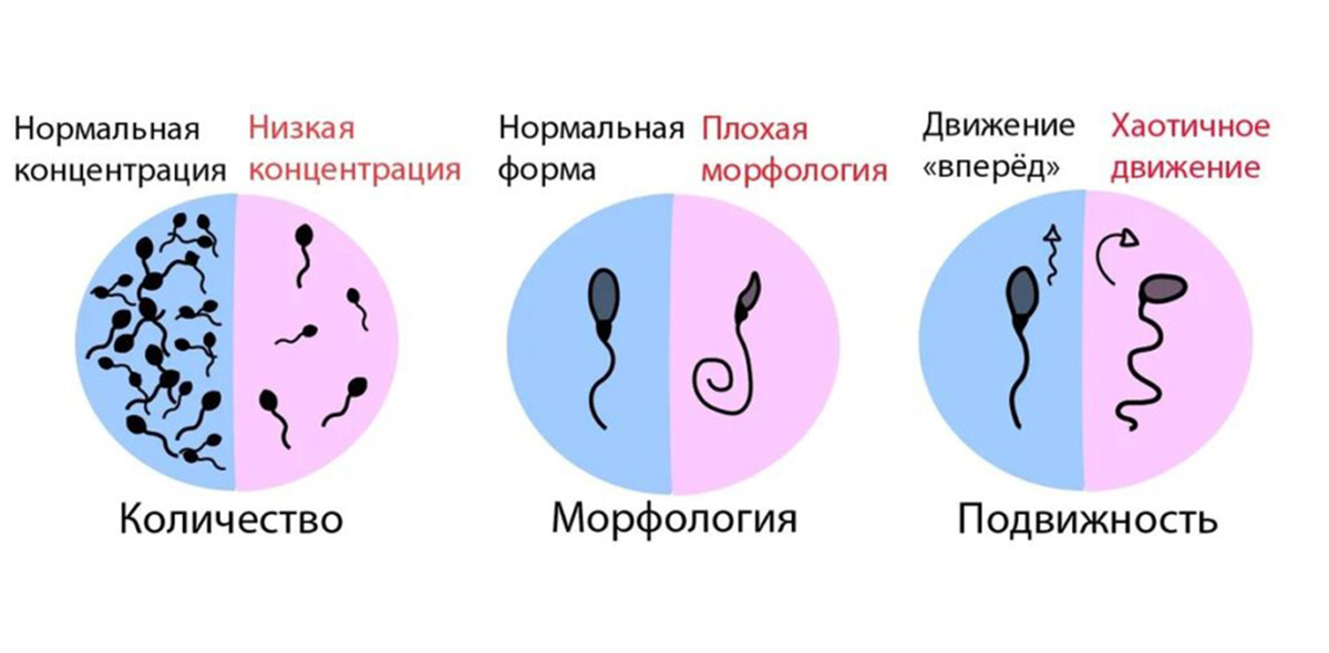 Как улучшить качество спермы. Лаборатория