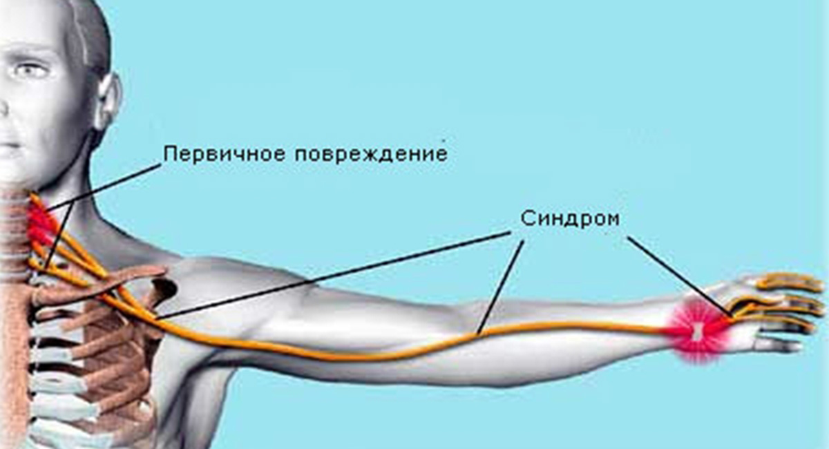 лестничная мышца лестничная мышца