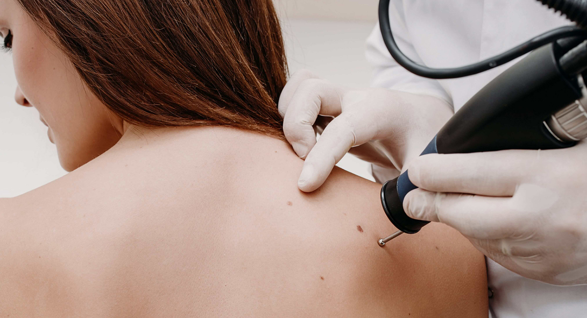 Что означают родинки Что означают родинки