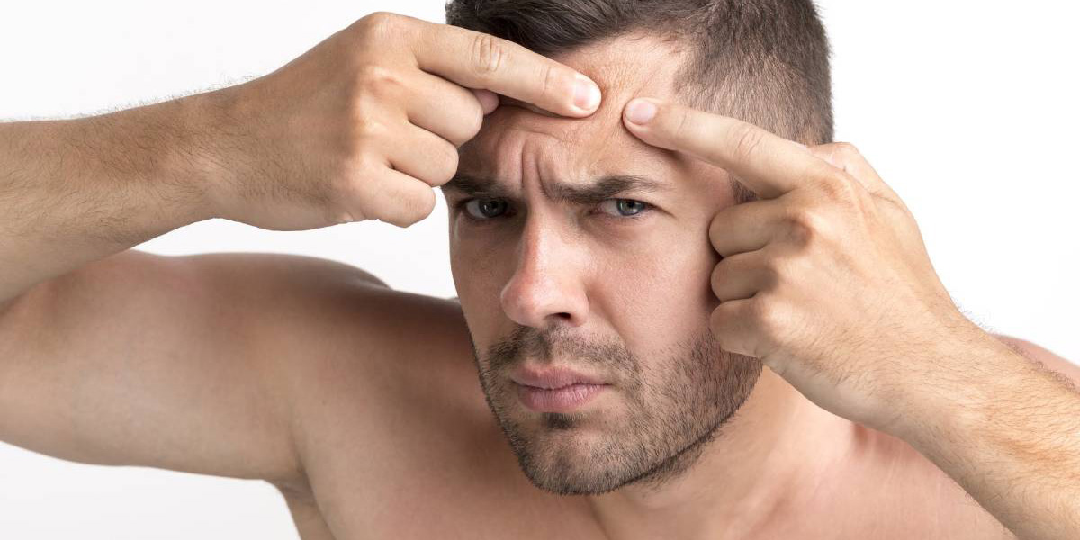 прыщи у взрослых прыщи у взрослых