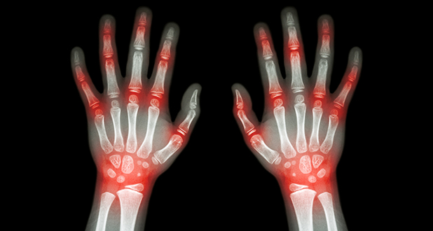 шишки на руках шишки на руках