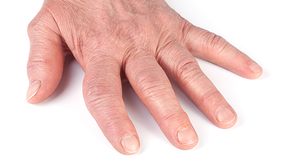 шишки на руках шишки на руках