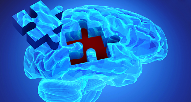 Склероз Склероз