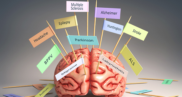 Склероз Склероз