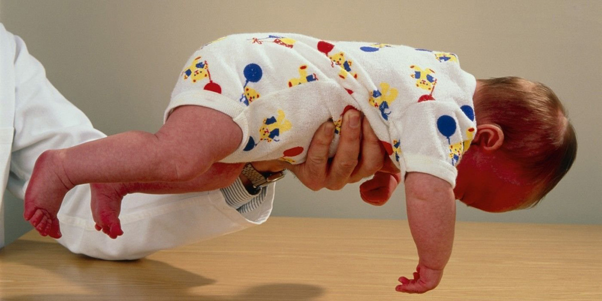 Гипертонус у ребенка, врач Гипертонус у ребенка, врач