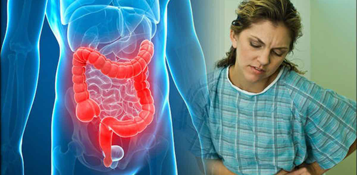 Неспецифический язвенный колит лечение Неспецифический язвенный колит лечение