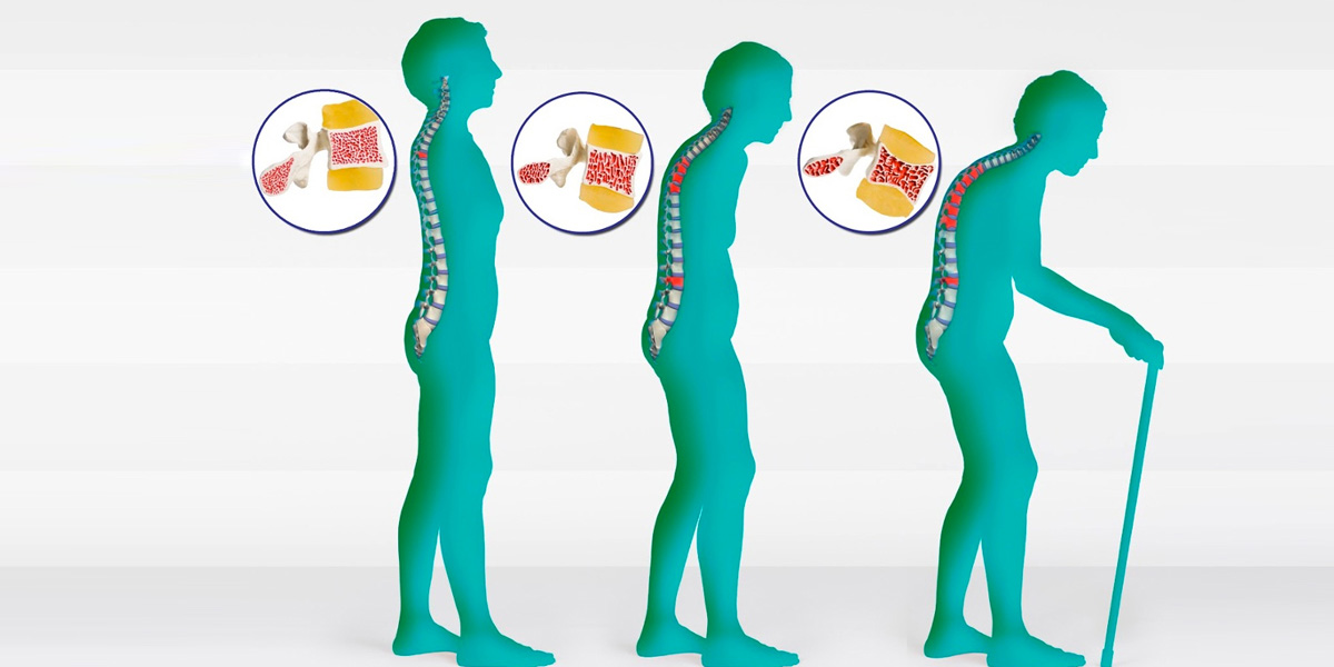 гормональная терапия гормональная терапия