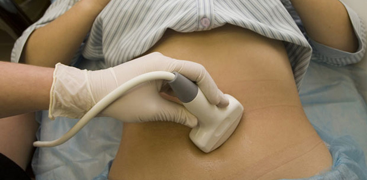 Рак яичников Рак яичников