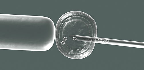 ЭКО оплодотворение, под микроскопом ЭКО оплодотворение, под микроскопом