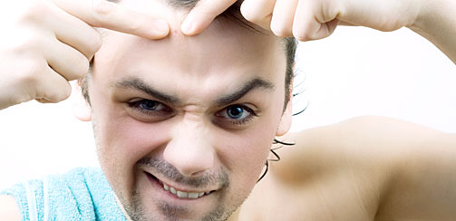 Как избавиться от акне. Прыщи Как избавиться от акне. Прыщи