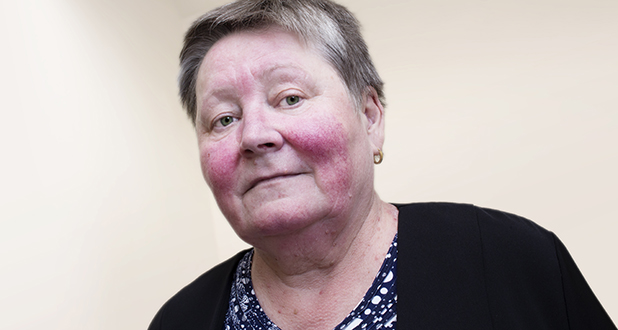 Купероз Купероз